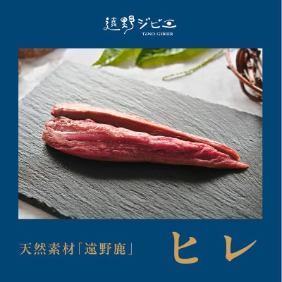 鹿ãã¬è åèš400g 100gÃ4ãã㯠ãžããš é éåžç£ å·å é éãžããšã®éãé
éäžå¯å°åïŒé¢å³¶ãã1581871ã