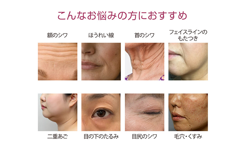 ã©ãžãªãã©ãã¬ãŒã·ã§ã³ ãããã¥ã¢ãšã¯ã»ã¬ã³ã(R) çŸå®¹ çŸè ããªãŒãã¡ã³ã ãã§ã€ã¹ã±ã¢ ãã€ã³ãã±ã¢