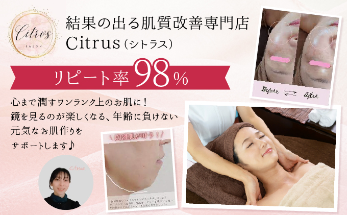 しわ改善コース（陶肌トリートメント＋CYリキッド）　275P8402