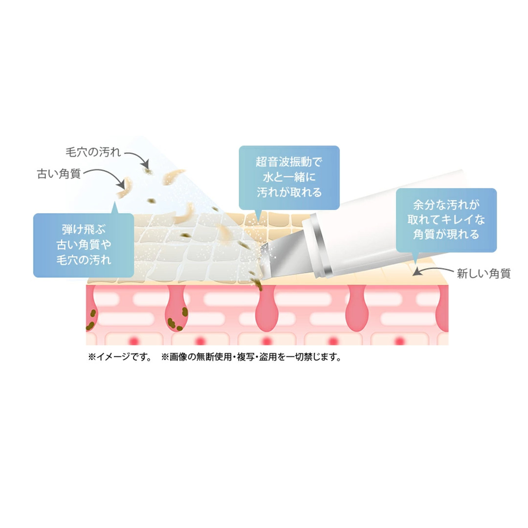 【ギフト対応】 美ルル アクアルファクラシック（ウォーターピーリング美顔器）ホワイト 超音波 ウォーターピーリング 美顔器 イオン導出 イオン導入 保湿 リフトアップ エイジングケア 毛穴ケア 美肌 belulu New AquaRufa classic ギフト プレゼント [DD88-NT]