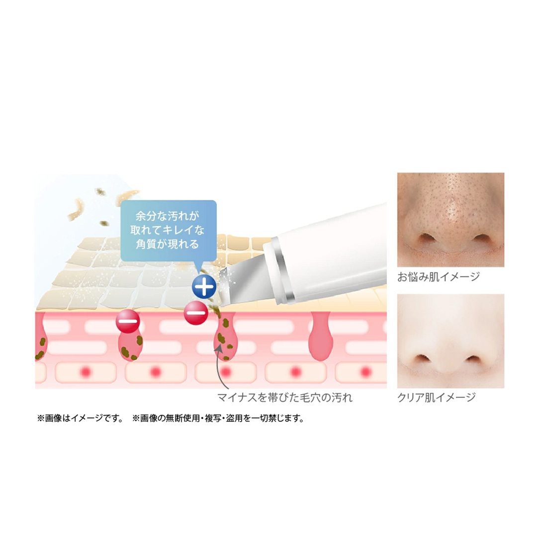 【ギフト対応】 美ルル アクアルファクラシック（ウォーターピーリング美顔器）ピンク 超音波 ウォーターピーリング 美顔器 イオン導出 イオン導入 保湿 リフトアップ エイジングケア 毛穴ケア 美肌 belulu New AquaRufa classic ギフト プレゼント [DD89-NT]