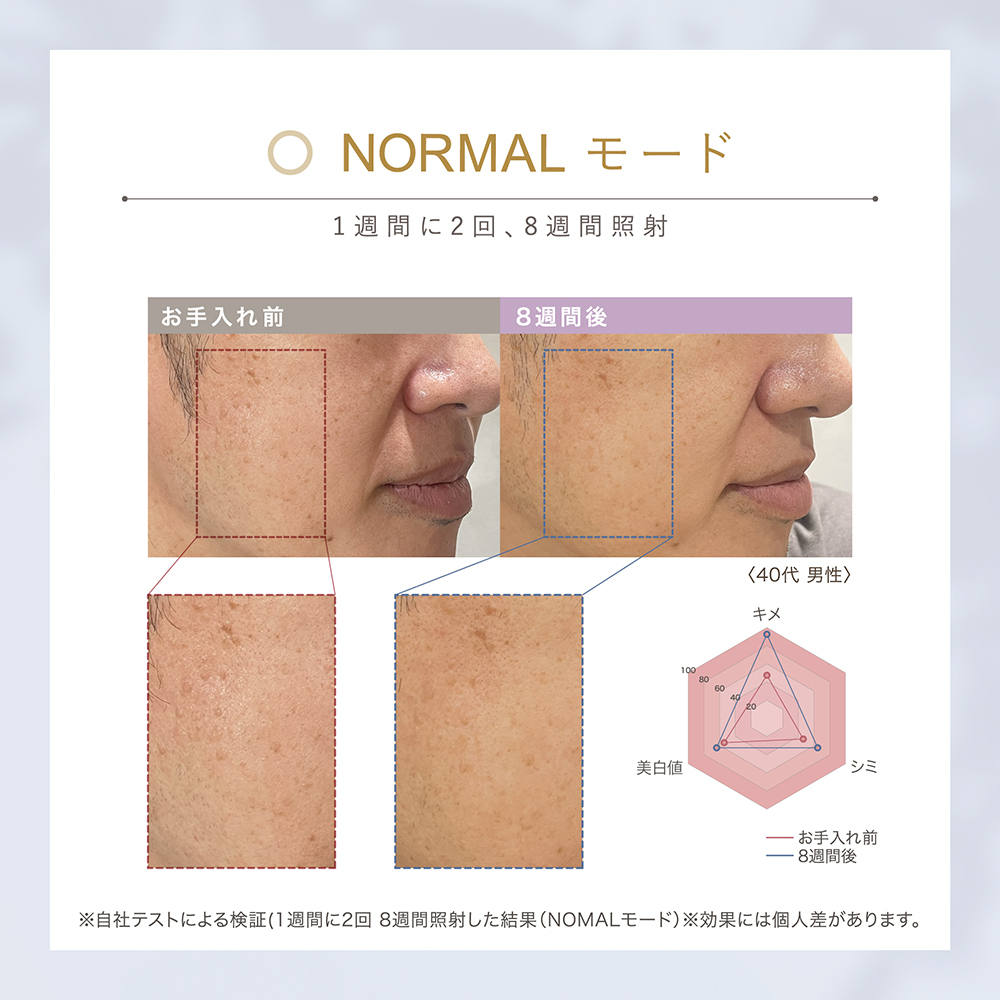 LINKA スノー フラッシュ（DPL_NIR 光美容器） LINKA リンカ 美顔器 美白 美容 スキンケア 美容家電 エステ フォトフェイシャル [EV07-NT]