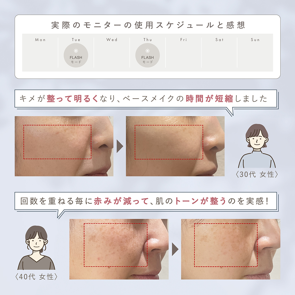 LINKA スノー フラッシュ（DPL_NIR 光美容器） LINKA リンカ 美顔器 美白 美容 スキンケア 美容家電 エステ フォトフェイシャル [EV07-NT]