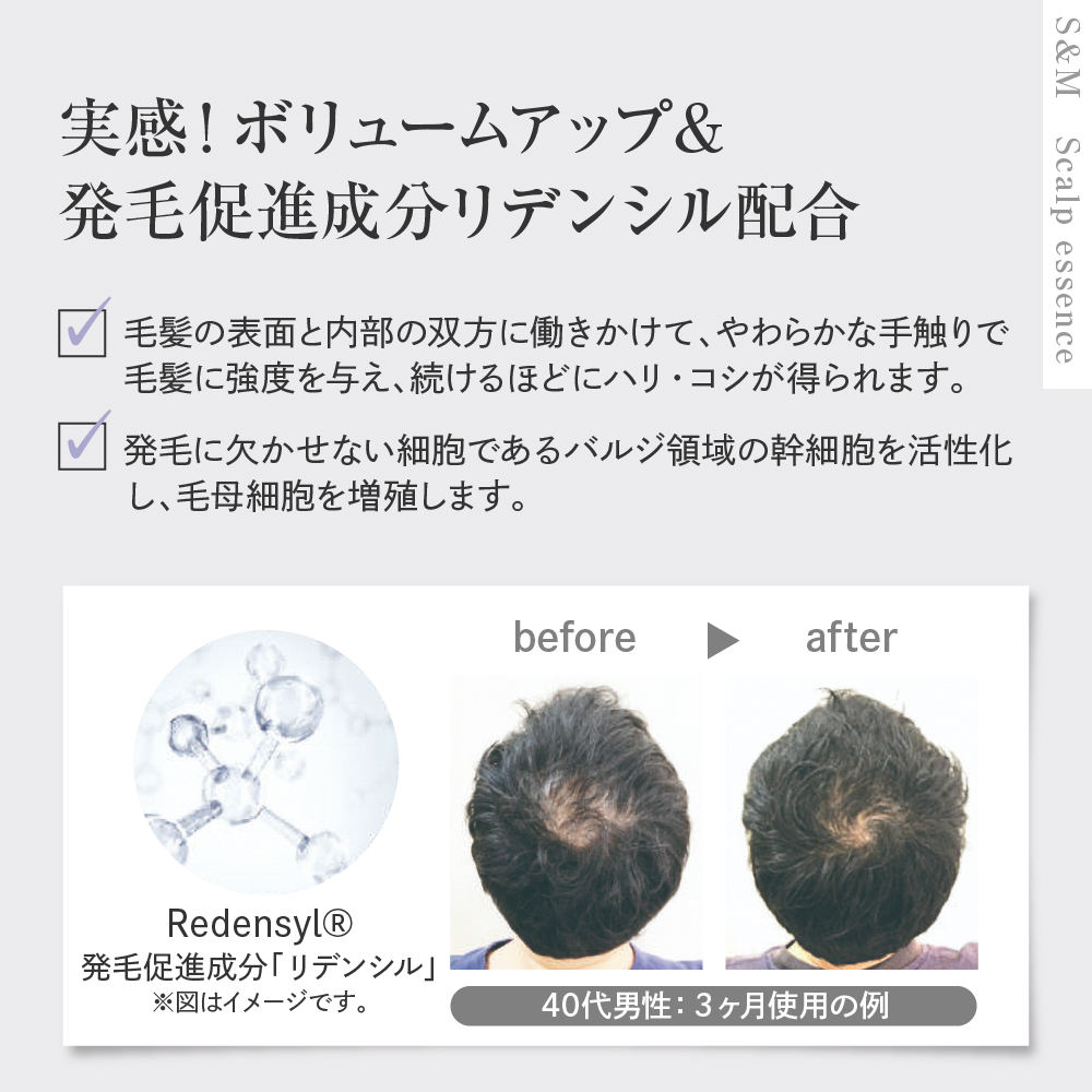 SANシMONI 繧ケ繧ュ繝」繝ォ繝励お繝繧サ繝ウ繧ケ 300ml 鄒、鬥ャ逵 蜊莉」逕ー逕コ 隧ー繧∵崛縺 繝ャ繝輔ぅ繝ォ 繧ケ繧ォ繝ォ繝 繧ィ繝繧サ繝ウ繧ケ 逋コ豈帑ソ騾イ 閧イ豈 阮ャ逕ィ 騾∵侭辟。譁