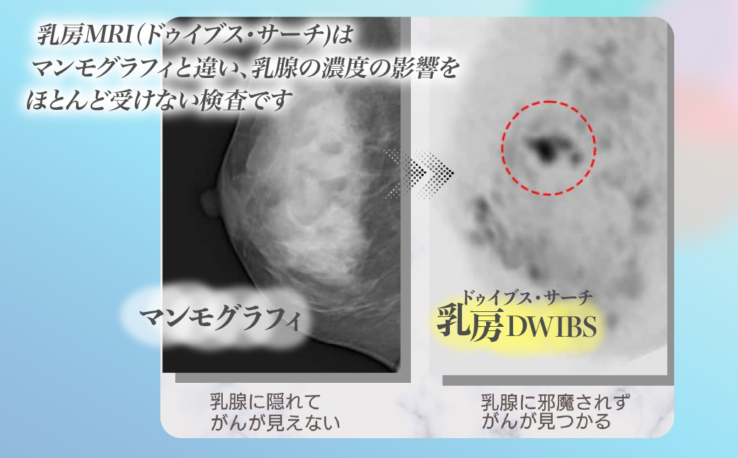 乳房DWIBS (痛くないMRI乳がん検診) チケット | 予約 乳房MRI MRI 乳がん がん MRI検査 検診 検査 医療 クリニック 永仁会 シーズクリニック 埼玉県 所沢市