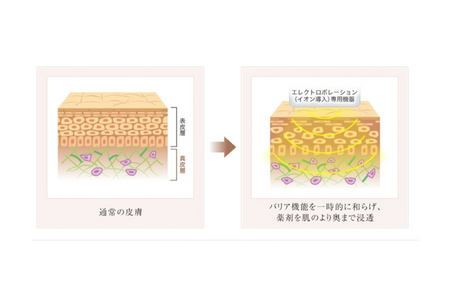 イオン 導入 ベビー スキン ライト（顔）1回 藤沢院／SBC 湘南 美容 クリニック ふるさと納税 施術券 利用券 チケット 神奈川県 藤沢市