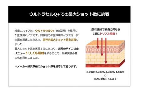 ウルトラ リフト プラスHIFU 830 ショット 全顔＋首 1回 藤沢院／SBC 湘南 美容 クリニック ふるさと納税 施術券 利用券 チケット HIFU  超音波 引き締め 神奈川県 藤沢市