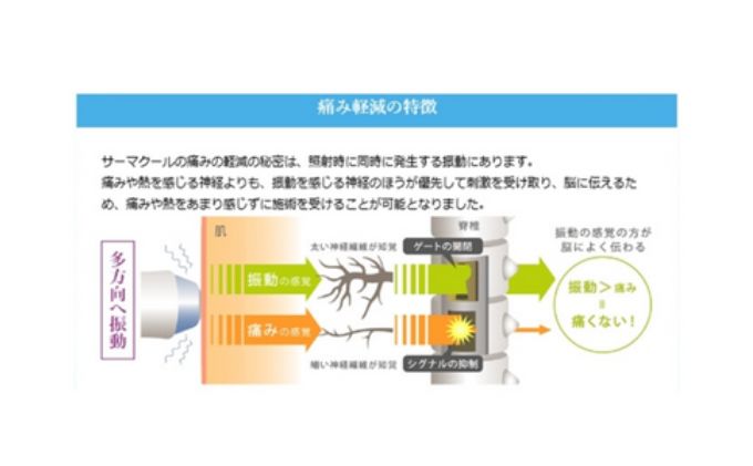 美容 神奈川 目元 専用 サーマクール 450 ショット 1回 体験 チケット 藤沢院 SBC 湘南 美容 クリニック 利用券 アンチエイジング エステ 湘南美容 湘南美容クリニック 神奈川県 藤沢市 藤沢