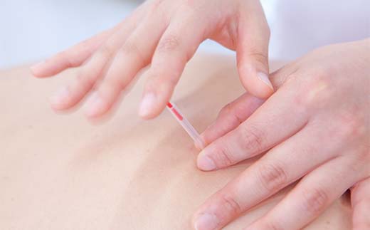 ã倧åãªæ¹ãžã®ãã¬ãŒã³ãã«ã ã®ãããã©ã³ïŒ20åã«ãŠã³ã»ãªã³ã°ïŒ60åãããµãŒãžïŒ 倧è寺治çé¢ éŒçž æ²»ç æŽäœ ç²åŽå埩 ãã¬ãŒã³ã çã F6P-2797