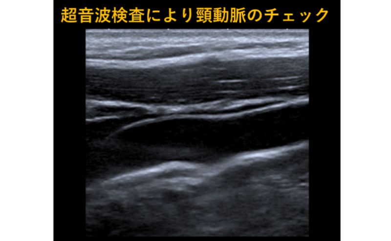簡易脳ドック受診券1名分 脳ドック 利用 クーポン券 健康診断 チケット 人間ドック 浜松PET診断センター 検診 MR検査 超音波検査 血液検査 静岡 浜松市