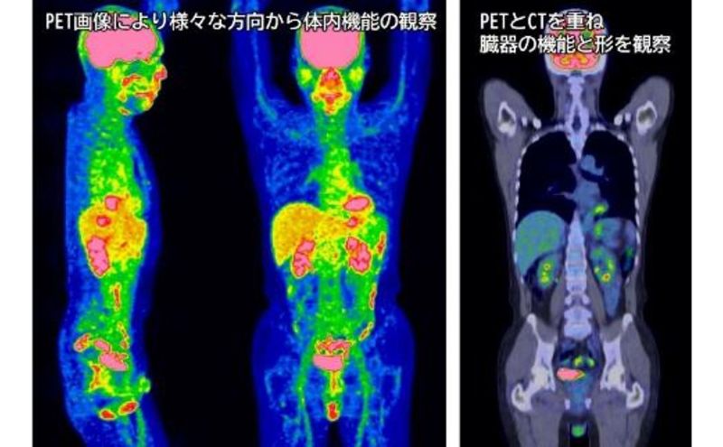 PETがん検診/PET-CTコース受診券1名分 PET PET-CT がん検診 利用 クーポン券 健康診断 チケット 人間ドック 浜松PET診断センター 検診 PET検査 静岡 浜松市