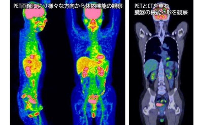 PETがん検診/総合コース受診券1名分 PET がん 利用 クーポン券 健康診断 チケット 人間ドック 浜松PET診断センター 検診 CT MRI 超音波 画像診断 静岡 浜松市