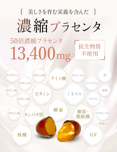 0006-101-02 ILUS 繝励Λ繧サ繝ウ繧ソシ繧ウ繝ゥ繝シ繧イ繝ウ 1陲 (30譌・)