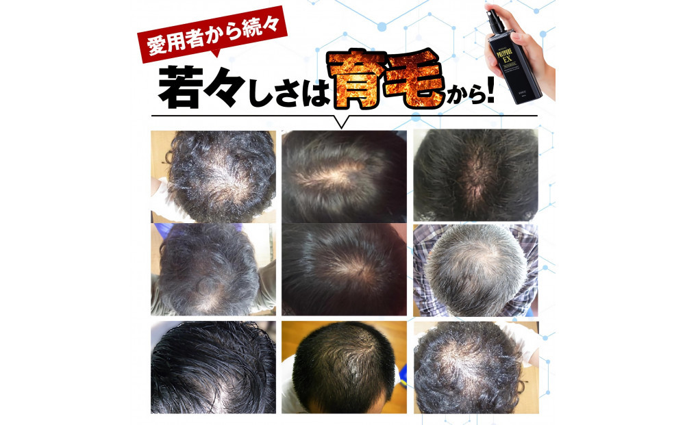 ポリピュアEX 120ml × 5本セット 医薬部外品 薬用 育毛剤 男性用 女性用 育毛 発毛 促進 薄毛 抜け毛予防