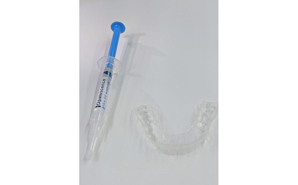 【ご来院必須】ホームホワイトニング　special whitening ticket　(専用マウスピース作製付）