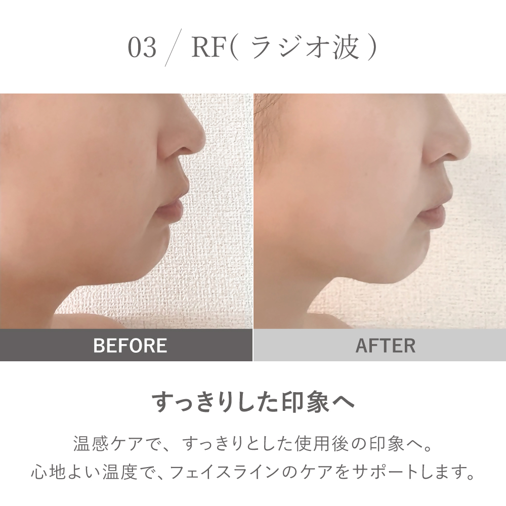 ãLOABI/ãã¢ãå
¬åŒã ãã«ãçŸé¡åš NITENA ããã