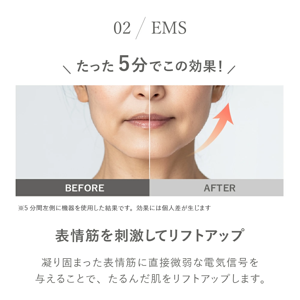 ãLOABI/ãã¢ãå
¬åŒã ãã«ãçŸé¡åš NITENA ããã