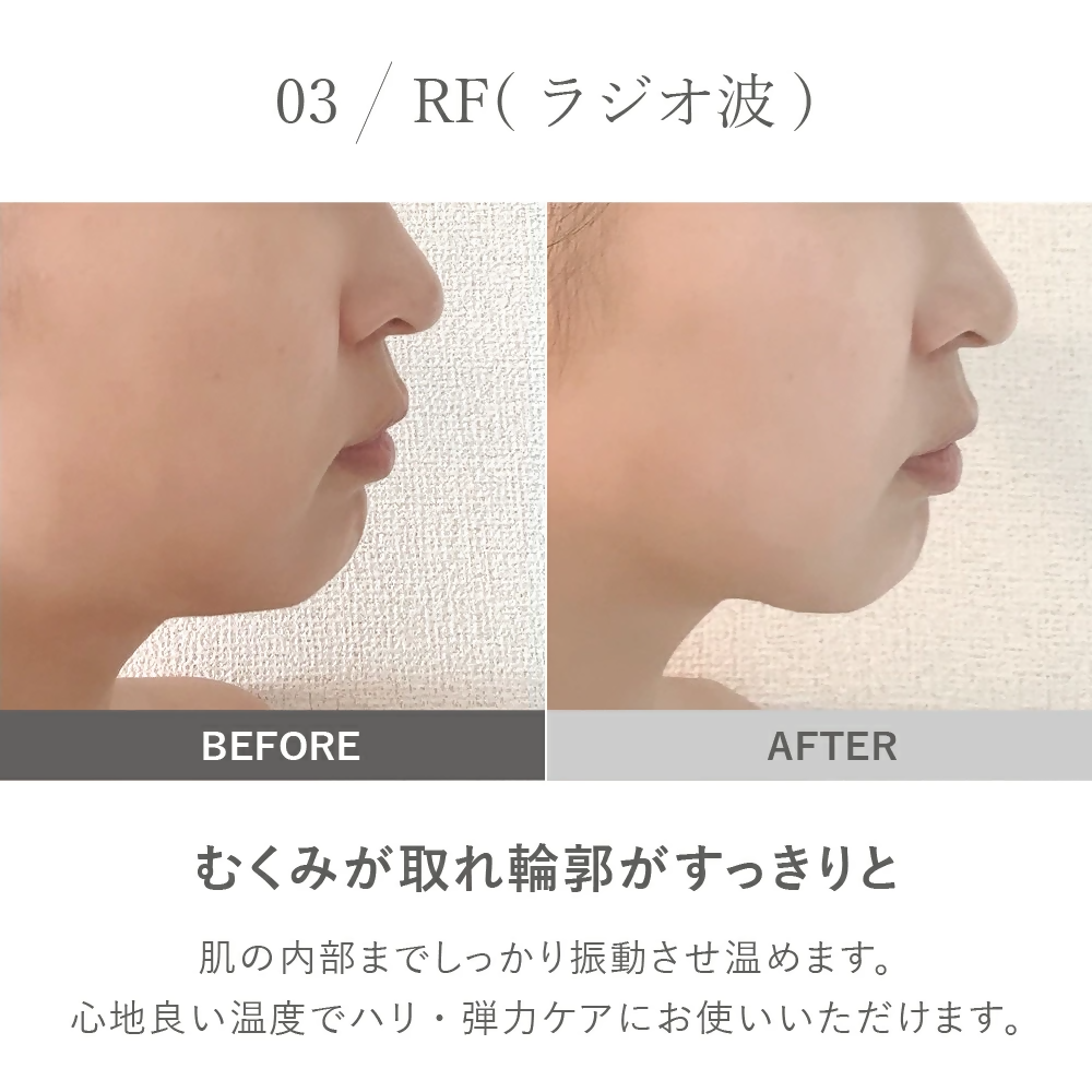 ãLOABI/ãã¢ãå
¬åŒã ãã«ãçŸé¡åš NITENA ããã