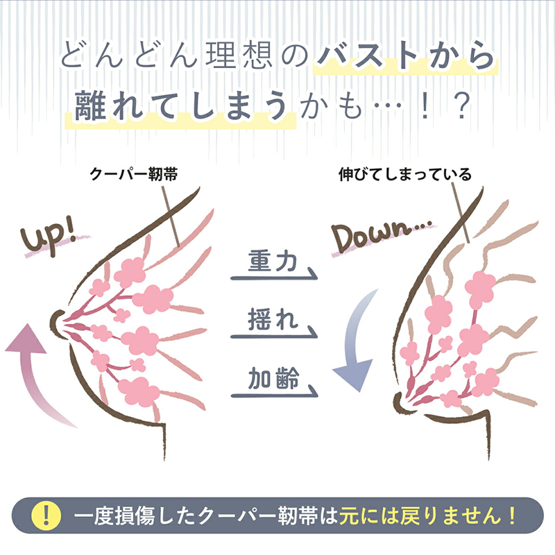 極楜ãã©ïŒãã€ããã©ïŒ