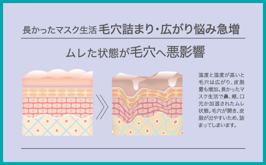 【78-02】薬用 GG バランシングローション　NIKIPITA（ニキピタ）