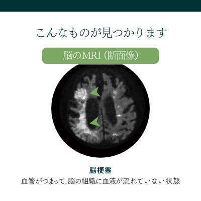 身体の健康診断を受けるなら、脳の状態も知っておいた方がいい!約30分で終わる日帰り脳ドック!【1450274】
