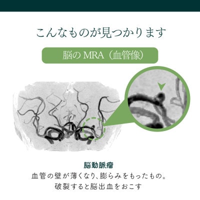 身体の健康診断を受けるなら、脳の状態も知っておいた方がいい!約30分で終わる日帰り脳ドック!【1450274】