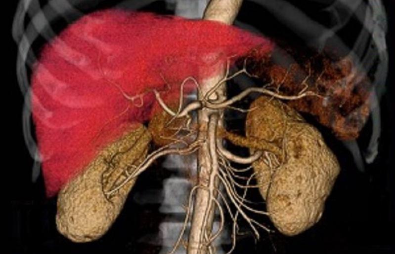 IGTクリニック 特殊がん検診 マイクロアレイ【がん専門 クリニック 泉佐野市 りんくう】