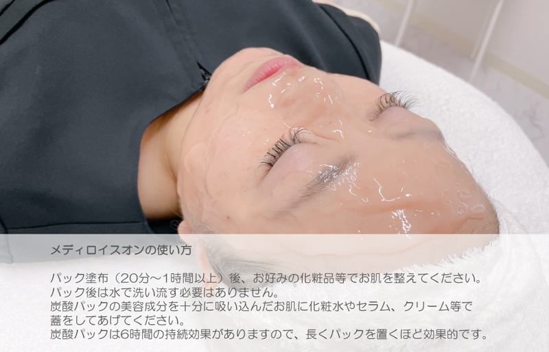 かたまる生炭酸パック メディロイスオン