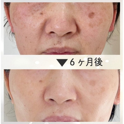 ã女æ§éå®ãçµæã«ãã ãã£ã28幎ã®ç¶ºéºã«ãªããšã¹ãã³ãŒã¹(ãã§ã€ã·ã£ã«orããã£)ã1572890ã