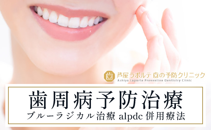 歯周病予防治療、ブルーラジカルP-01治療とalpdc併用療法（歯周病からの寛解）｜口腔ケア 歯 健康 歯周病 オーラルケア 歯医者 マウスウォッシュ 歯科治療 歯科 ラポルテ 芦屋市 歯の予防 080-a003