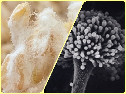 腸活習慣 健康食品アモン 麹のちから 発芽玄米 カルシウム ウコン