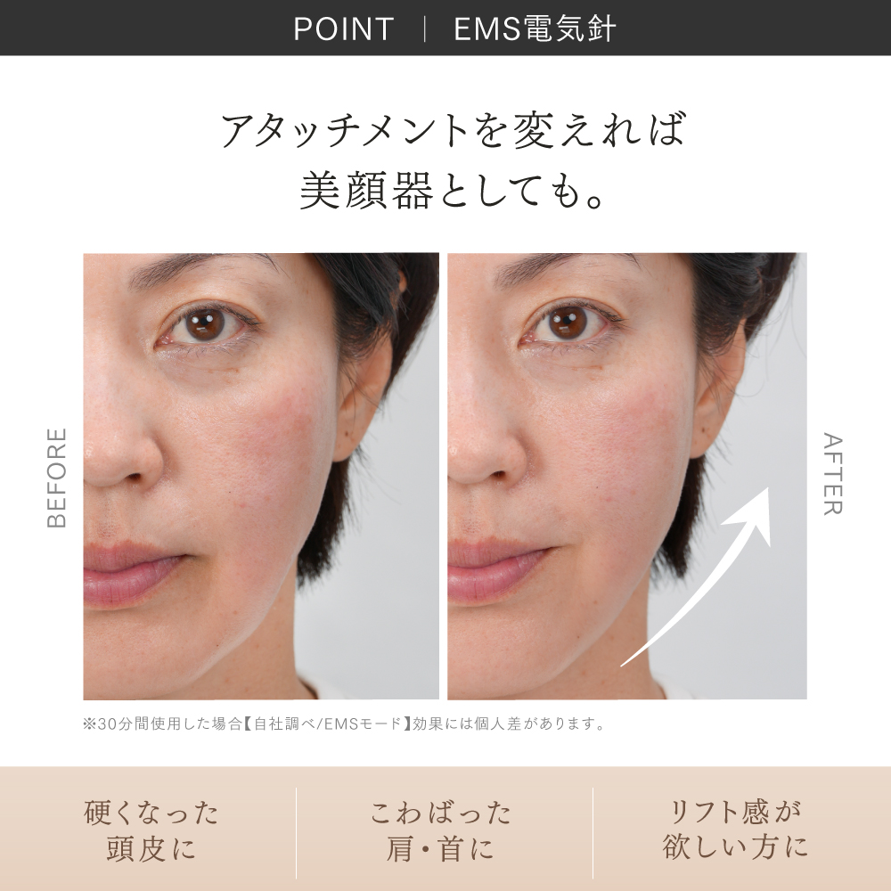 EMS ヘッドマッサージャー MYTREX HEAD SPA DeepX 電気針 頭皮ケア スカルプ 美顔器 リフトケア 顔 首 フェイス ボディ 防水 日用品 健康家電 美容家電 家電 マッサージ マッサージ機マイトレックス ヘッドスパ ディープエックス