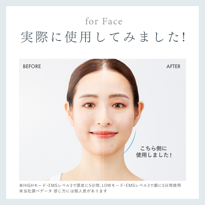 縲千ヲ丞イ。蟶ゅ鮮IPLUX 繝悶Λ繧キ蝙九Μ繝輔ヨ繧ア繧「 EMS LIFT BRUSH