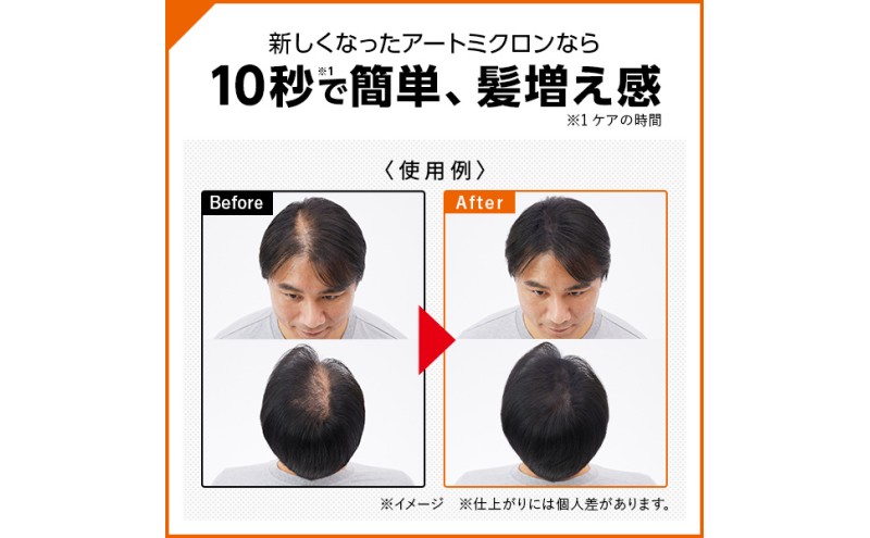 増毛 アートミクロン パウダー 20g ブラック 髪 つむじ ボリュームアップ 頭皮 ヘアスタイル ヘア 薄毛 白髪