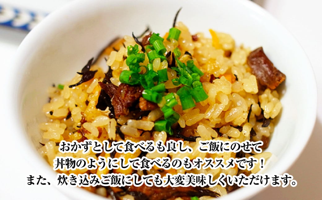 くじら 大和煮 缶詰 170g×5個セット 計850g 鯨 クジラ肉 保存食 缶詰め