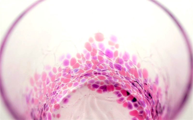 ããã¿ã®ããšãããããã¯ã°ã©ã¹ïŒã€ãšã¶ã¯ã©ãã³ã¯ïŒ1å